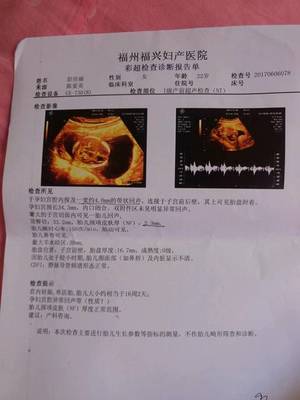 谁会看是男是女的,帮我看看吧