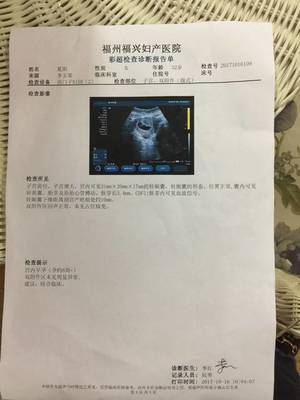 带着7周的B超进来猜猜男女吧!
