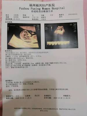 福州福兴妇产医院 NT检查与胎儿性别的关系