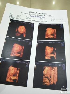 生命的选择 福州福兴妇产医院的守护