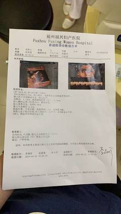 NT顺利通过！福州福兴妇产医院专业护航，见证生命早期健康