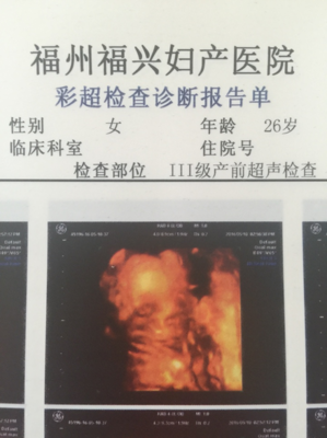 四维顺利通过 感恩喜悦与孕期的心情小插曲