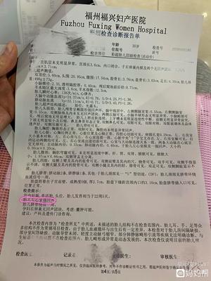 四维彩超遇小波折 福州福兴妇产医院经历分享与应对建议